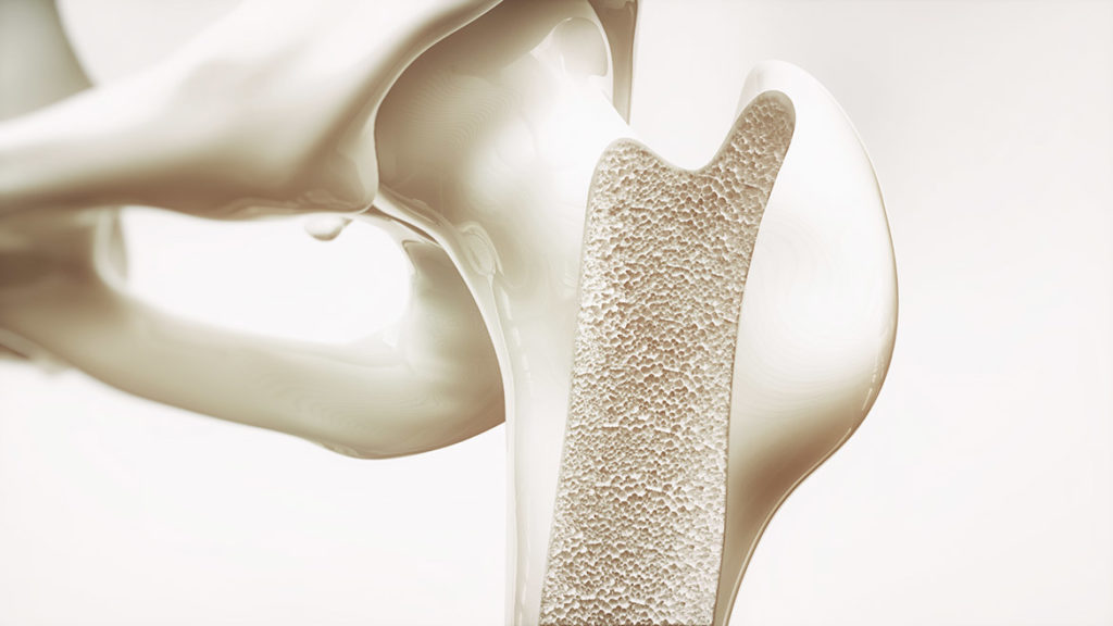 I beneficidel collagene per l'osteoporosi